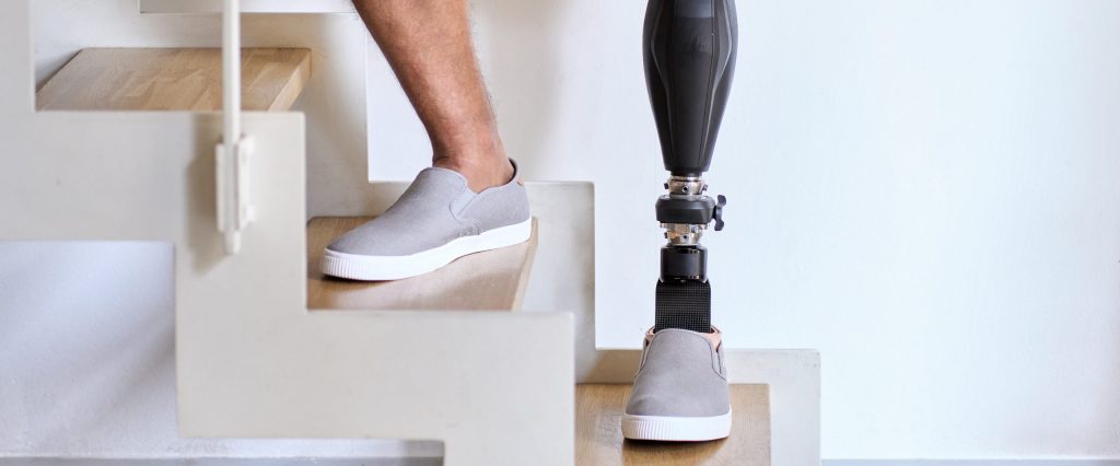 Amputee man with above knee leg prosthesis standing on feet, close up.